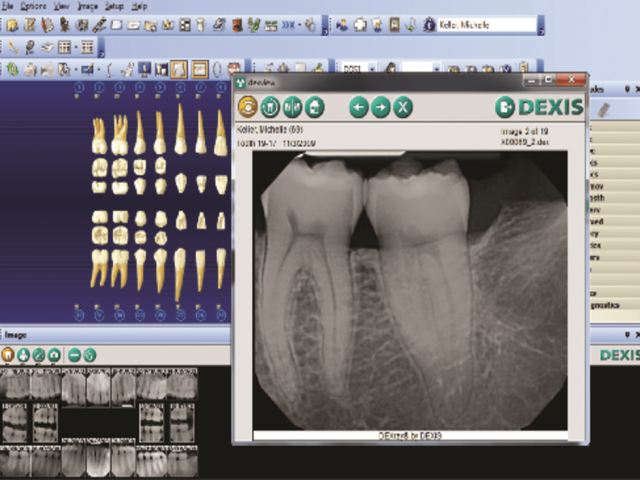 dental-emr-software, HIS-software-in-dubai