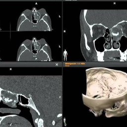 PACS and DICOM