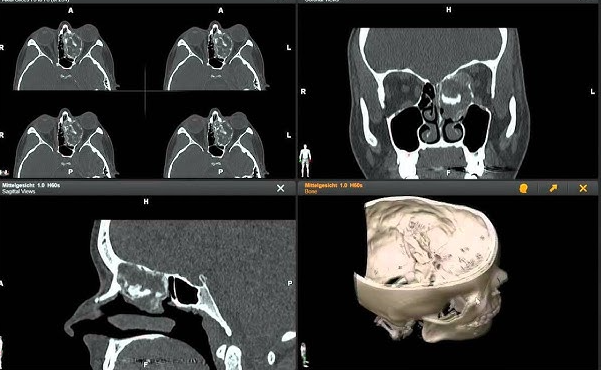PACS and DICOM